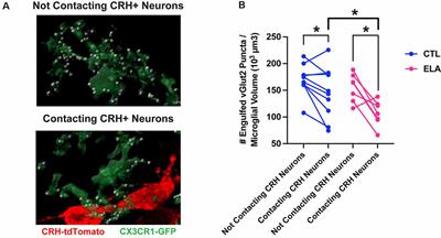 Microglia Don’t Treat All Neurons the Same: The Importance of Neuronal Subtype in Microglia-Neuron Interactions in the Developing Hypothalamus